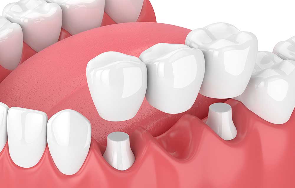 Millburn Emergency Dentist