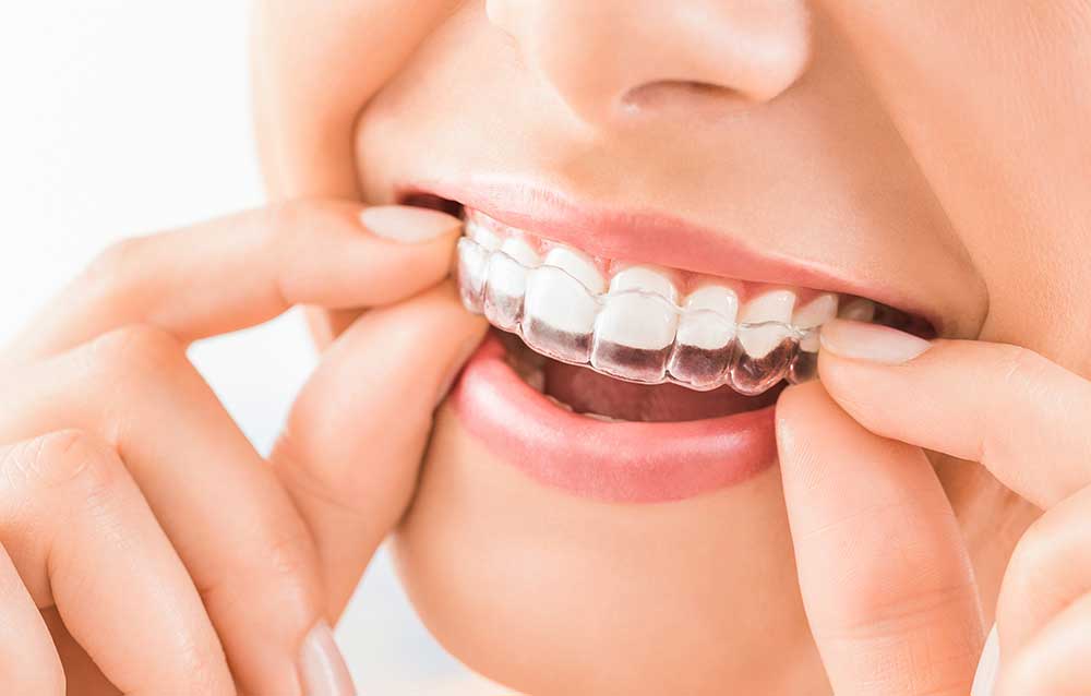 Family Dentist in Millburn