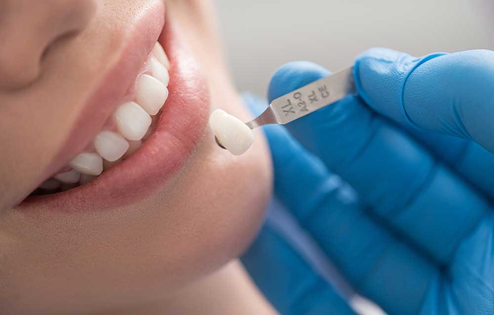Millburn Cosmetic Dentist
