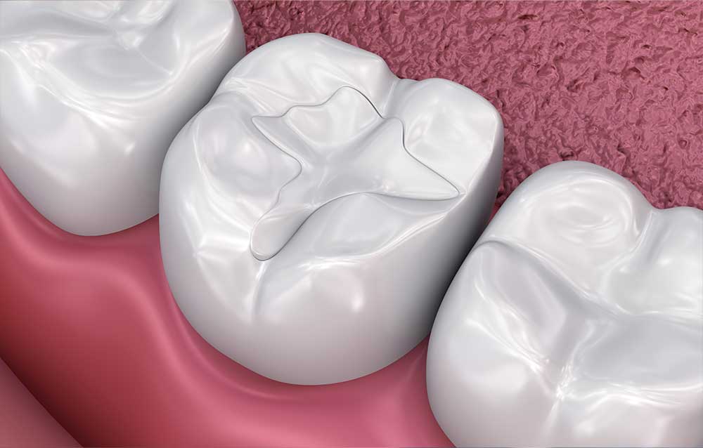 Dentist in Millburn
