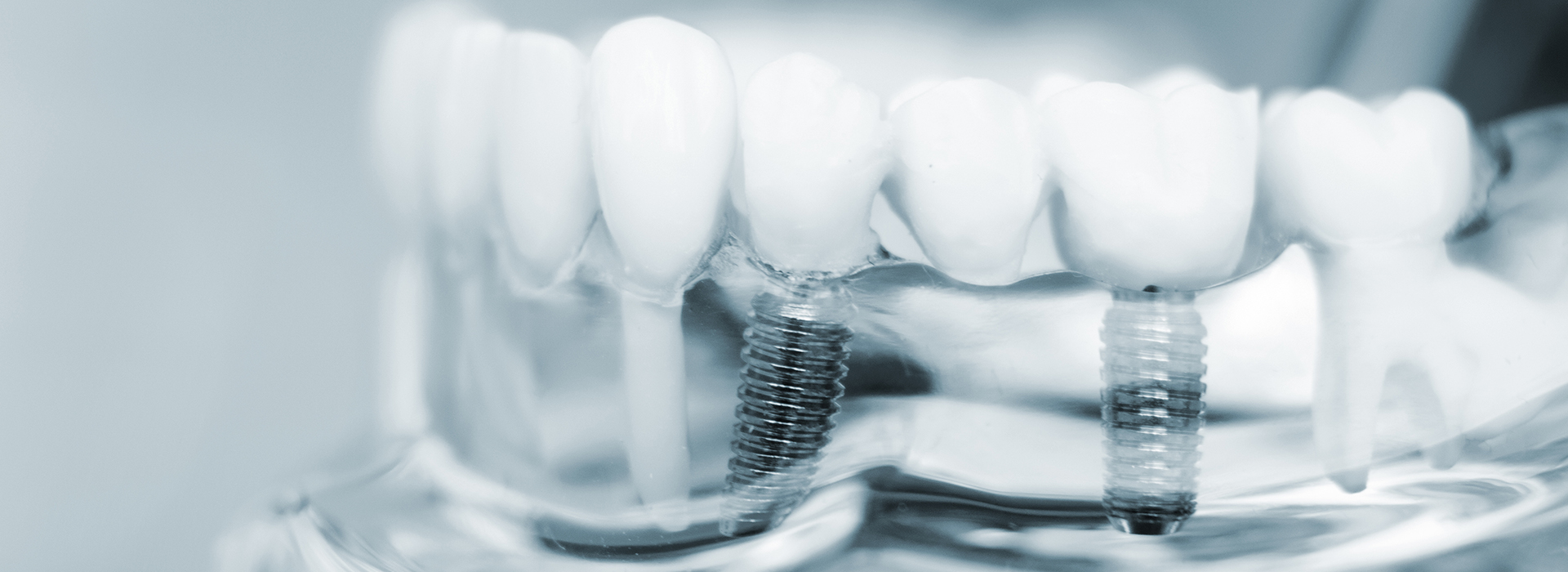 Scheier Dental | Dental Fillings, Pediatric Dentistry and Dentures